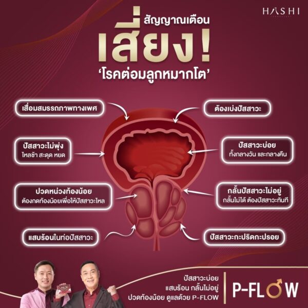 P-Flow แก้ปัญหาต่อมลูกหมากโต